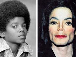 Sans chirurgie esthétique, le visage de Michael Jackson aurait ressemblé à cela