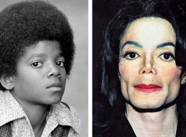 Sans chirurgie esthétique, le visage de Michael Jackson aurait ressemblé à cela